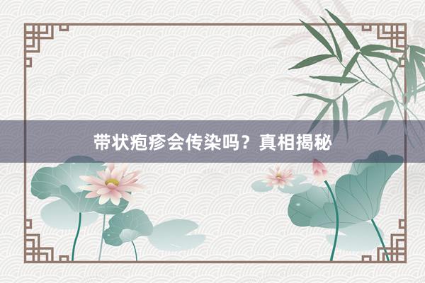 带状疱疹会传染吗？真相揭秘